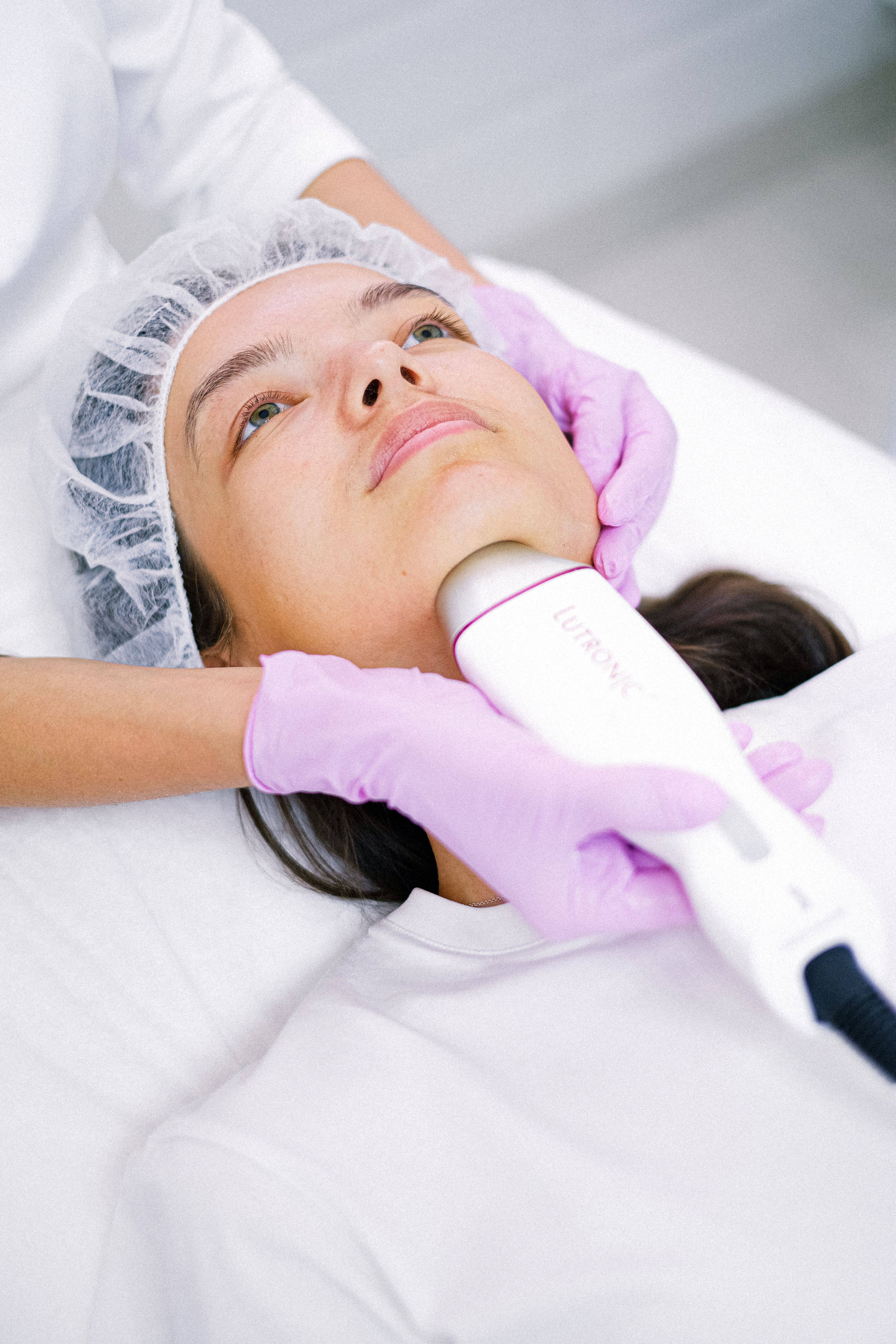 Morpheus8 collagen stimulation and skin tightening treatment